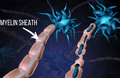 Why Your Myelin is Important to Your Overall Health image
