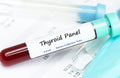 Will Myetin® Affect My Thyroid Test Results? image